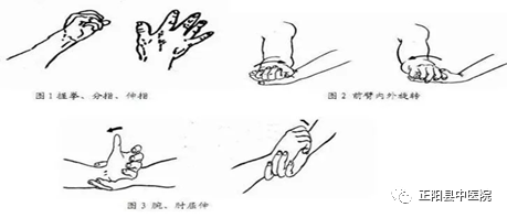 上肢怎么康复【正中医｜科普】上肢骨折术后如何正确的进行康复锻炼_https://www.jmylbn.com_新闻资讯_第9张