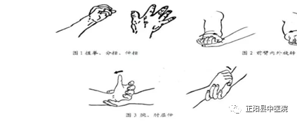 上肢怎么康复【正中医｜科普】上肢骨折术后如何正确的进行康复锻炼_https://www.jmylbn.com_新闻资讯_第13张