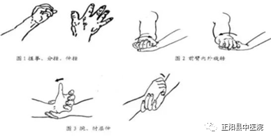 上肢怎么康复【正中医｜科普】上肢骨折术后如何正确的进行康复锻炼_https://www.jmylbn.com_新闻资讯_第18张