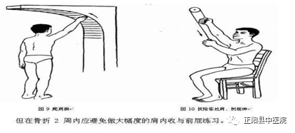 上肢怎么康复【正中医｜科普】上肢骨折术后如何正确的进行康复锻炼_https://www.jmylbn.com_新闻资讯_第12张