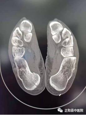 dr拍片怎么拍清晰【正中医｜科普】为什么四肢关节DR拍片时，常规为正侧位片？_https://www.jmylbn.com_新闻资讯_第8张