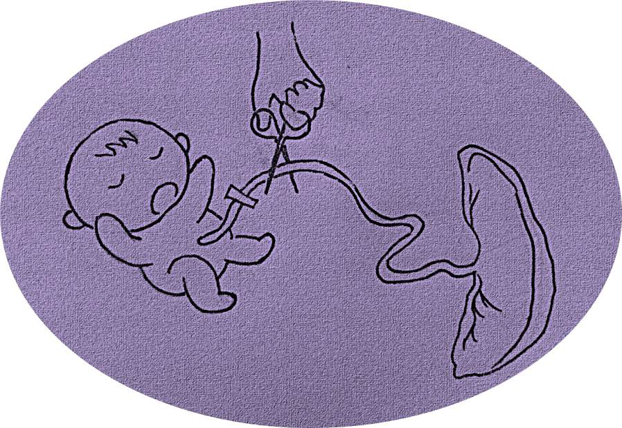 为什么剪脐带要先夹住医问医答 ｜ 你知道吗？肚脐长得丑其实跟那个给你剪脐带的医生没有半毛钱关系！_https://www.jmylbn.com_新闻资讯_第7张