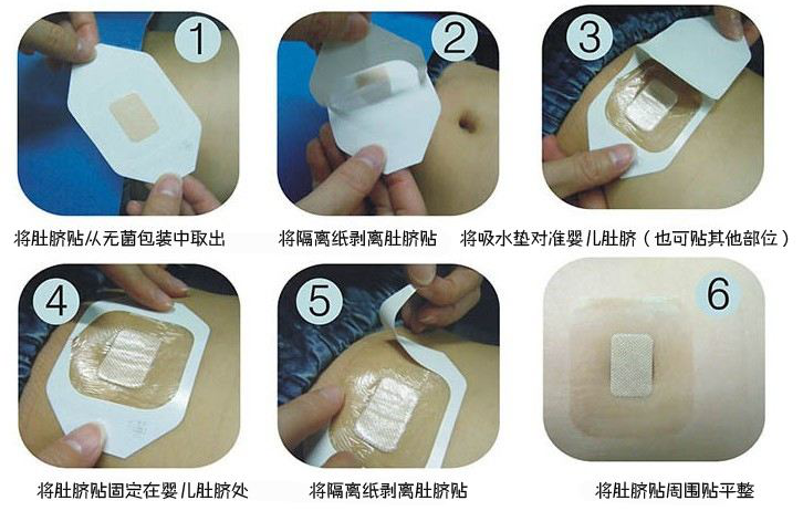 为什么剪脐带要先夹住医问医答 ｜ 你知道吗？肚脐长得丑其实跟那个给你剪脐带的医生没有半毛钱关系！_https://www.jmylbn.com_新闻资讯_第11张