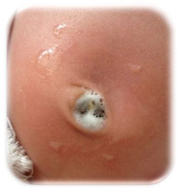 为什么剪脐带要先夹住医问医答 ｜ 你知道吗？肚脐长得丑其实跟那个给你剪脐带的医生没有半毛钱关系！_https://www.jmylbn.com_新闻资讯_第13张