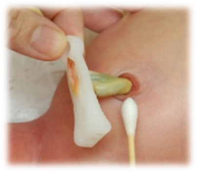 为什么剪脐带要先夹住医问医答 ｜ 你知道吗？肚脐长得丑其实跟那个给你剪脐带的医生没有半毛钱关系！_https://www.jmylbn.com_新闻资讯_第8张