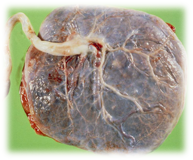 为什么剪脐带要先夹住医问医答 ｜ 你知道吗？肚脐长得丑其实跟那个给你剪脐带的医生没有半毛钱关系！_https://www.jmylbn.com_新闻资讯_第6张