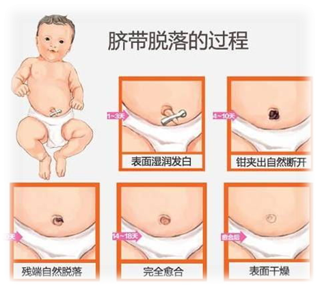 为什么剪脐带要先夹住医问医答 ｜ 你知道吗？肚脐长得丑其实跟那个给你剪脐带的医生没有半毛钱关系！_https://www.jmylbn.com_新闻资讯_第9张