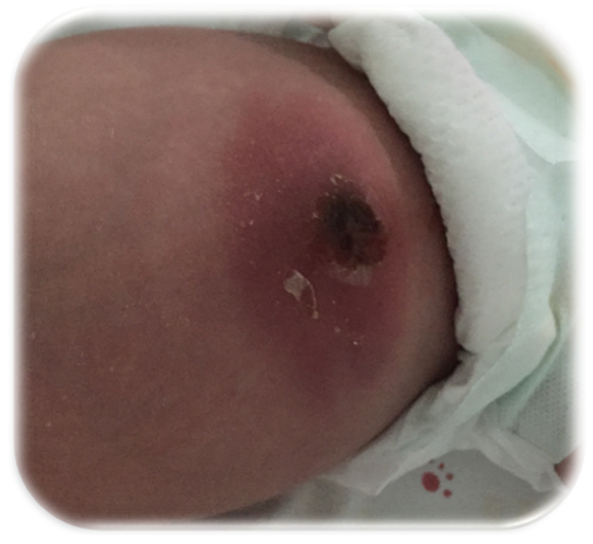 为什么剪脐带要先夹住医问医答 ｜ 你知道吗？肚脐长得丑其实跟那个给你剪脐带的医生没有半毛钱关系！_https://www.jmylbn.com_新闻资讯_第12张