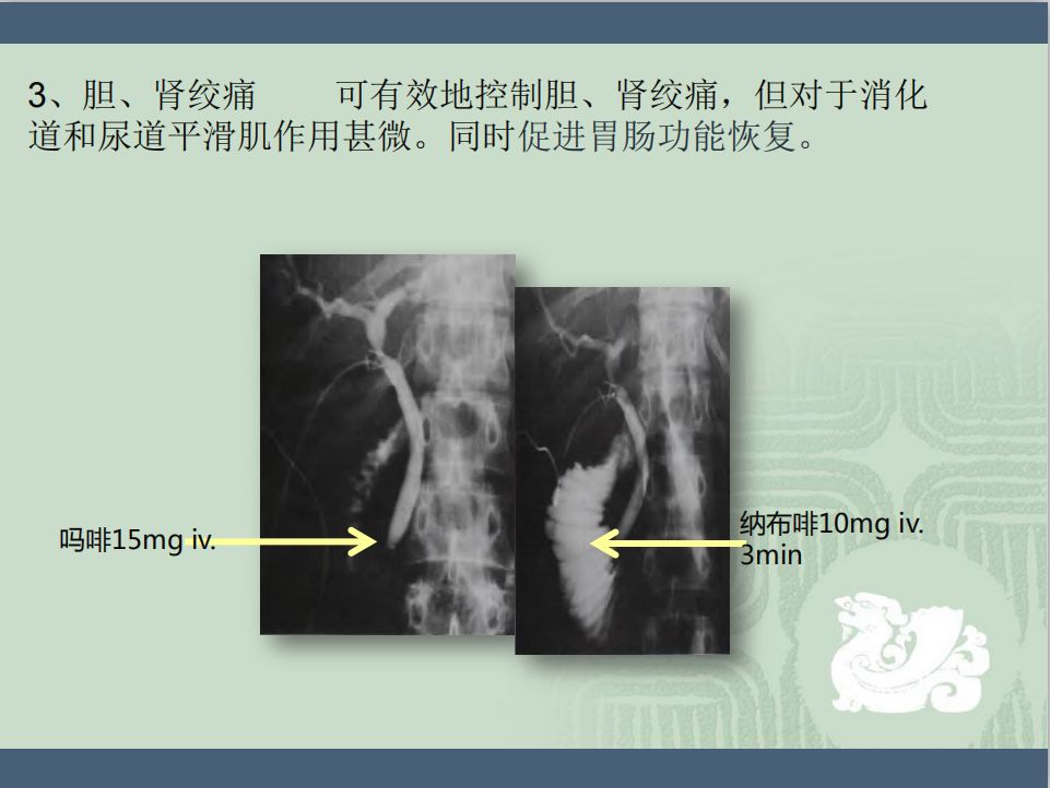 崔蘇揚教授——《阿片受體激動拮抗劑的臨床應用》 健康 第3張