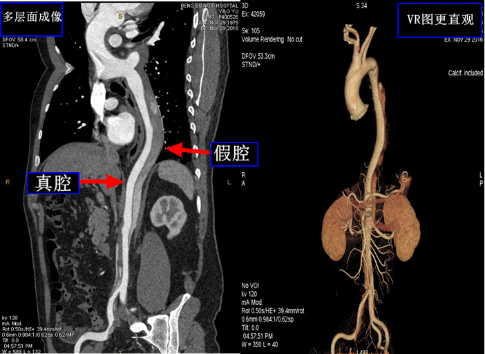 乳腺dr能检查什么【科普】DR、CT、MR？放射科检查项目选哪个好？_https://www.jmylbn.com_新闻资讯_第3张