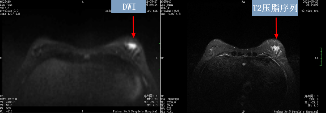 乳腺dr能检查什么【科普】DR、CT、MR？放射科检查项目选哪个好？_https://www.jmylbn.com_新闻资讯_第6张