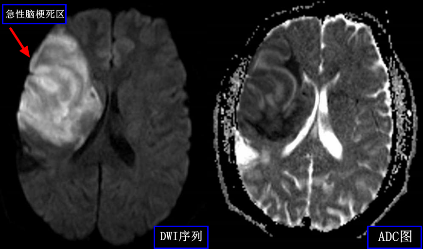 乳腺dr能检查什么【科普】DR、CT、MR？放射科检查项目选哪个好？_https://www.jmylbn.com_新闻资讯_第4张