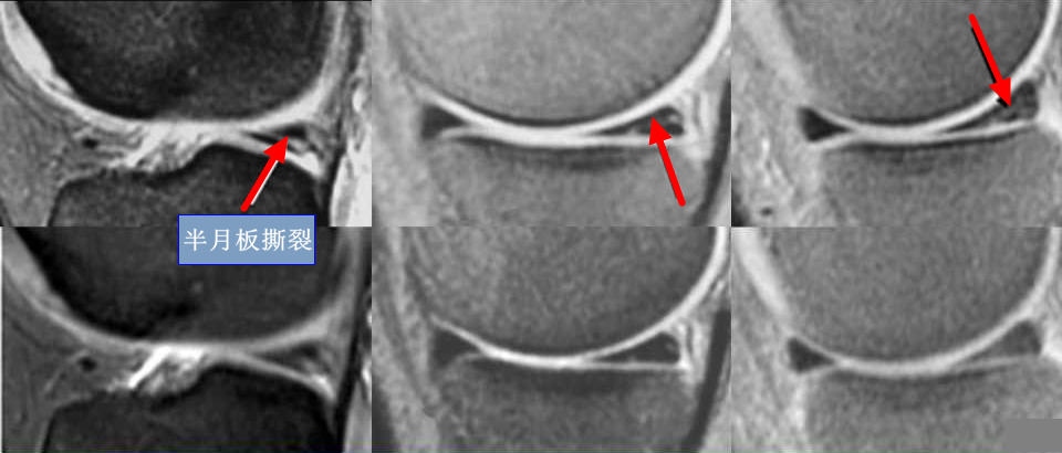 乳腺dr能检查什么【科普】DR、CT、MR？放射科检查项目选哪个好？_https://www.jmylbn.com_新闻资讯_第5张