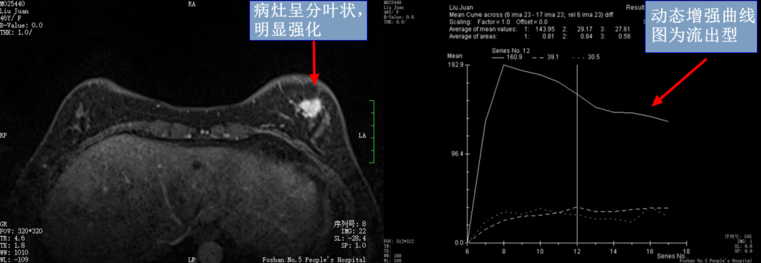 乳腺dr能检查什么【科普】DR、CT、MR？放射科检查项目选哪个好？_https://www.jmylbn.com_新闻资讯_第7张