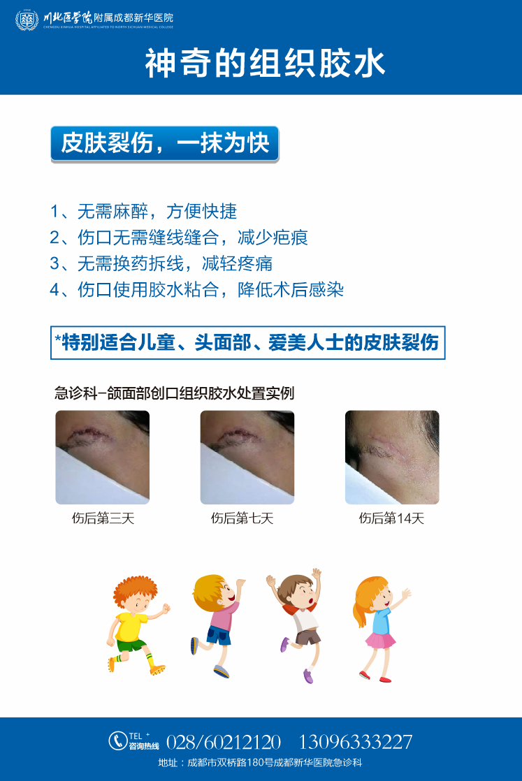 医用皮肤胶水是什么神奇的组织胶水 ｜ 皮肤裂伤，一抹为快-上海聚慕医疗器械有限公司
