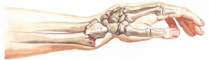 医疗康复包括什么骨质疏松性骨折：诊断、治疗和康复一文整理！_https://www.jmylbn.com_新闻资讯_第24张