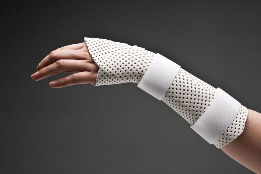 医疗康复包括什么骨质疏松性骨折：诊断、治疗和康复一文整理！_https://www.jmylbn.com_新闻资讯_第27张