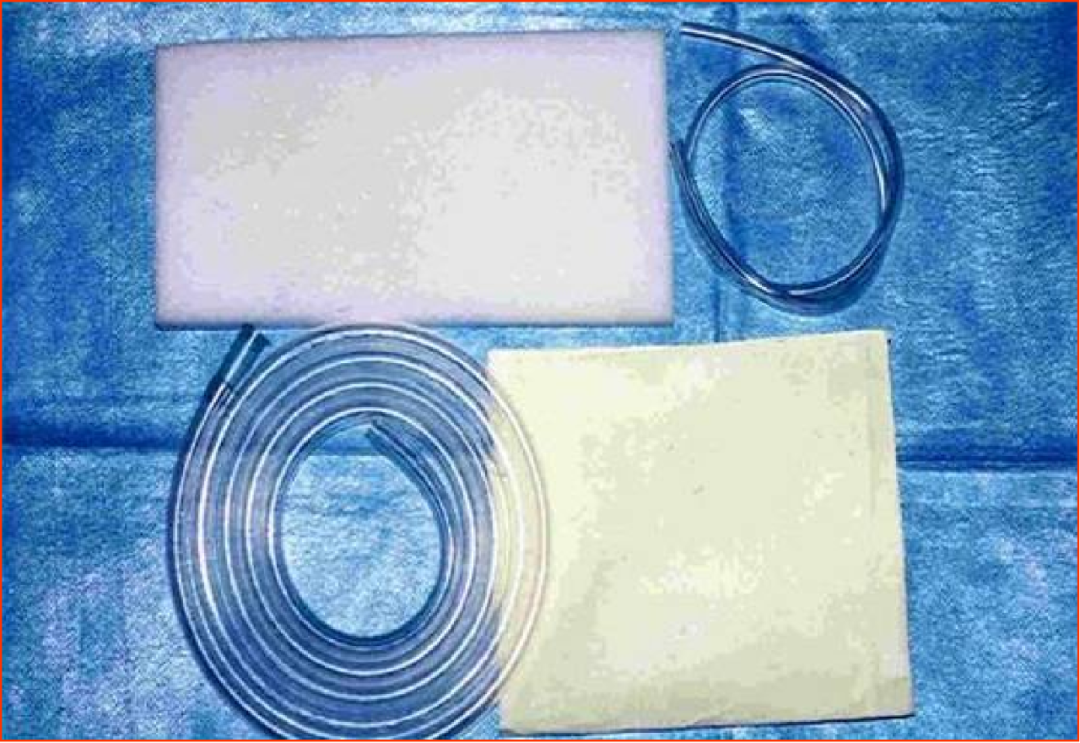 怎么促进vsd伤口愈合VSD技术，让伤口愈合更轻松_https://www.jmylbn.com_新闻资讯_第1张