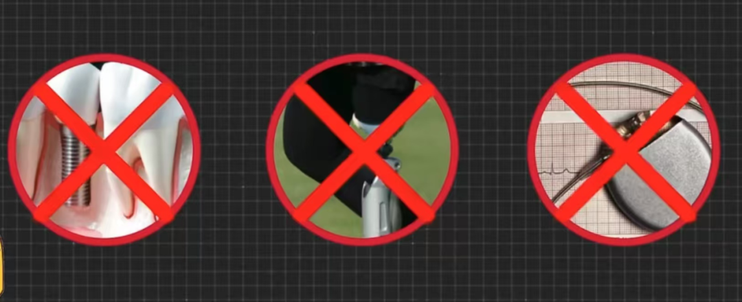 医学影像dr是什么科普宣教 ｜ 影像科检查DR、CT、MRI有何区别？_https://www.jmylbn.com_新闻资讯_第17张