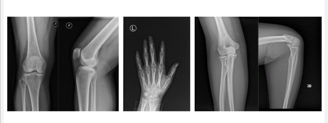 医学影像dr是什么科普宣教 ｜ 影像科检查DR、CT、MRI有何区别？_https://www.jmylbn.com_新闻资讯_第11张