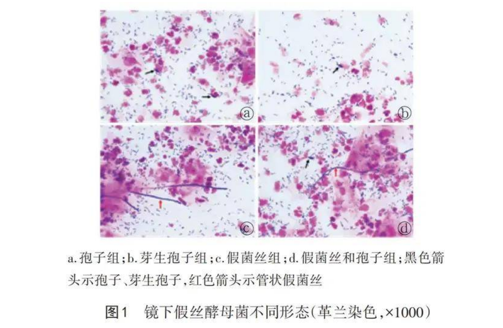 妇科流体敷料怎么用霉菌性阴道炎反复发作，久治不愈怎么办？锦露®妇科流体敷料调节阴道微生态，降低炎症复发！_https://www.jmylbn.com_新闻资讯_第2张