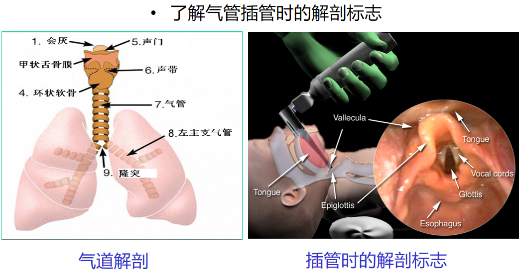喉镜镜片怎么选【新生儿复苏概论】中国新生儿窒息复苏项目标准（2020版）第五期：气管插管和喉罩气道_https://www.jmylbn.com_新闻资讯_第9张