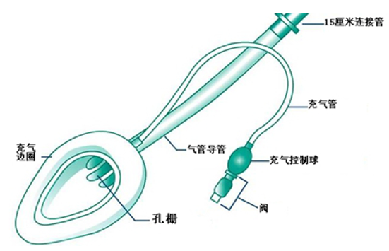 喉镜镜片怎么选【新生儿复苏概论】中国新生儿窒息复苏项目标准（2020版）第五期：气管插管和喉罩气道_https://www.jmylbn.com_新闻资讯_第18张