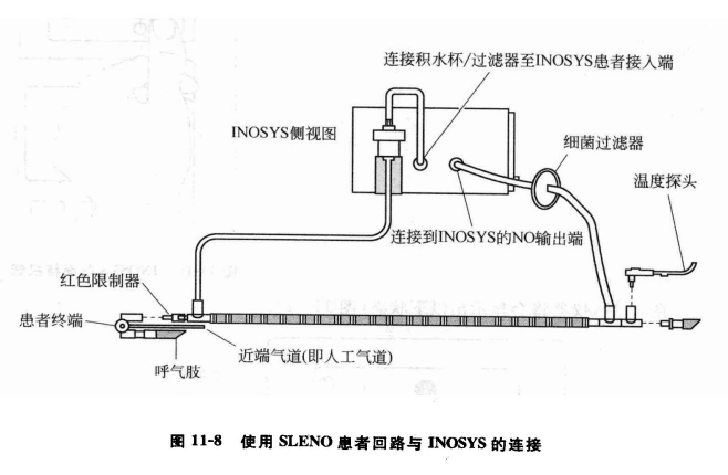 sle呼吸机是什么牌子【实用新生儿治疗技术】一氧化氮吸入疗法（三）—— 一氧化氮吸入装置_https://www.jmylbn.com_新闻资讯_第9张