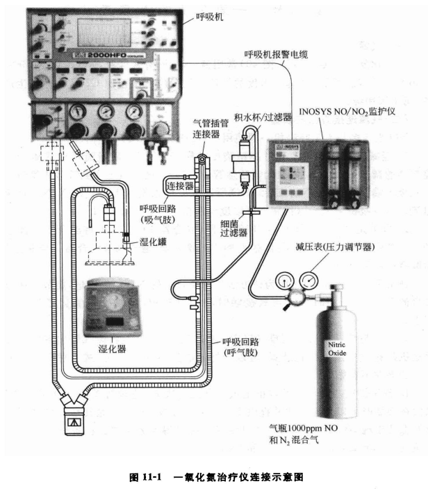 sle呼吸机是什么牌子【实用新生儿治疗技术】一氧化氮吸入疗法（三）—— 一氧化氮吸入装置_https://www.jmylbn.com_新闻资讯_第2张