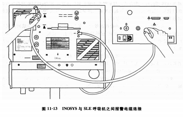 sle呼吸机是什么牌子【实用新生儿治疗技术】一氧化氮吸入疗法（三）—— 一氧化氮吸入装置_https://www.jmylbn.com_新闻资讯_第14张