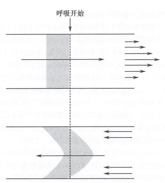 呼吸机f什么意思【实用】高频通气（一）分类与原理_https://www.jmylbn.com_新闻资讯_第2张