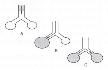 呼吸机f什么意思【实用】高频通气（一）分类与原理_https://www.jmylbn.com_新闻资讯_第3张