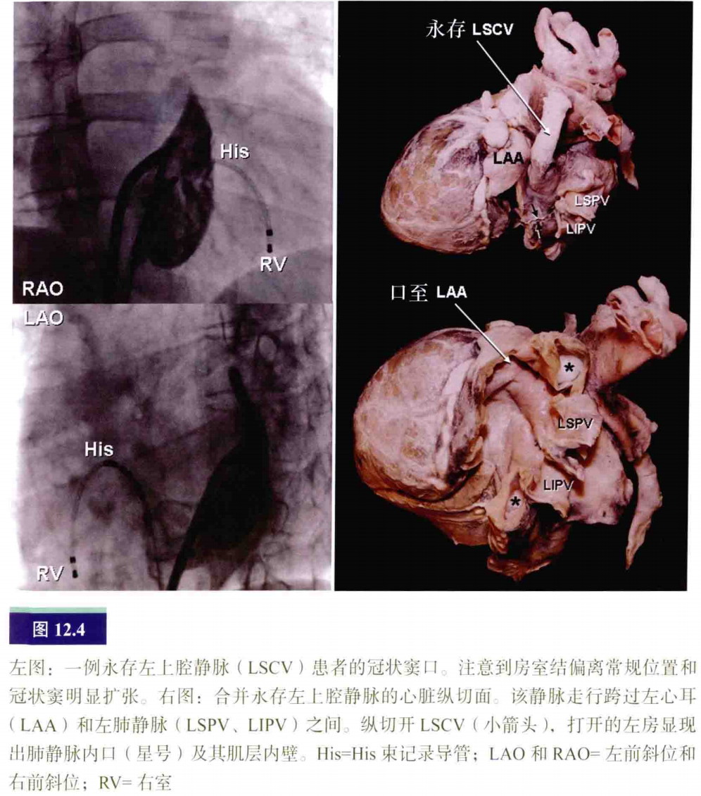 介入怎么进导管介入秘籍：心脏导管操作技巧_https://www.jmylbn.com_新闻资讯_第5张