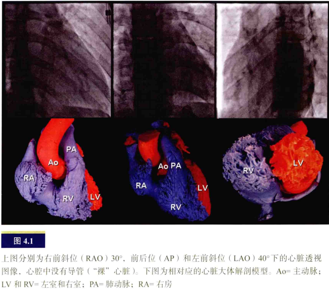 什么是电生理导管常规导管的放置：电生理和解剖_https://www.jmylbn.com_新闻资讯_第1张