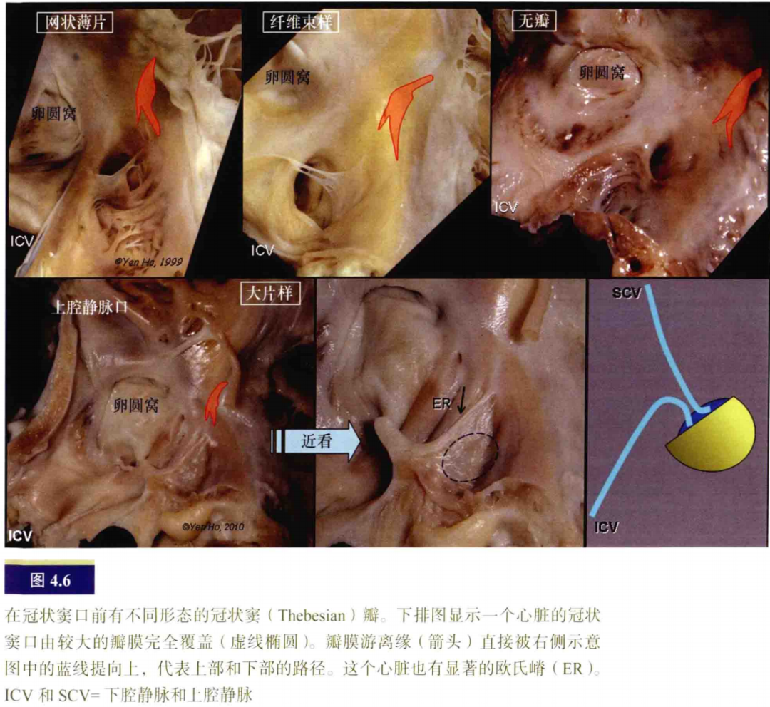 什么是电生理导管常规导管的放置：电生理和解剖_https://www.jmylbn.com_新闻资讯_第6张