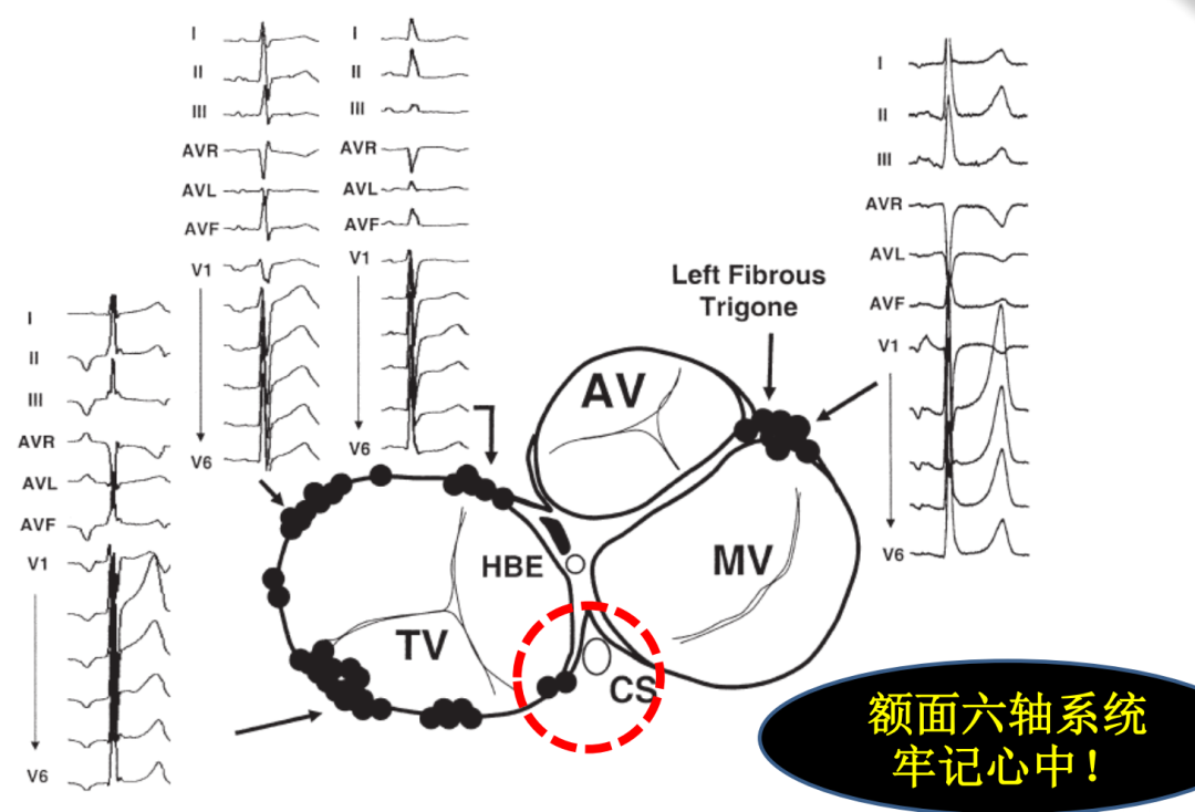 p心电图功能怎么开通异位起源P波的心电图定位_https://www.jmylbn.com_新闻资讯_第8张
