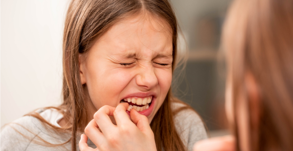 牙科材料硅胶怎么用如果你要做坏牙修复! 牙医告诉你怎么选材料和方案_https://www.jmylbn.com_新闻资讯_第1张