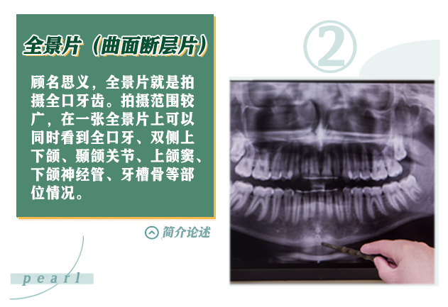 X光拍片为什么要等看牙为什么要拍片？非专业人士如何看懂自己的牙片！_https://www.jmylbn.com_新闻资讯_第5张