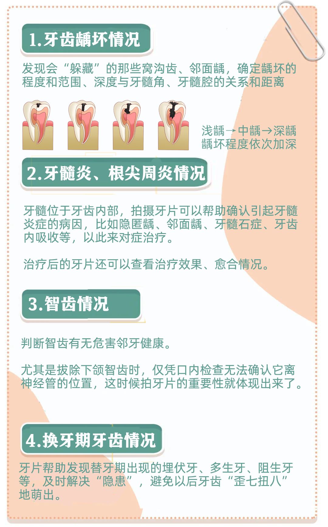 X光拍片为什么要等看牙为什么要拍片？非专业人士如何看懂自己的牙片！_https://www.jmylbn.com_新闻资讯_第2张