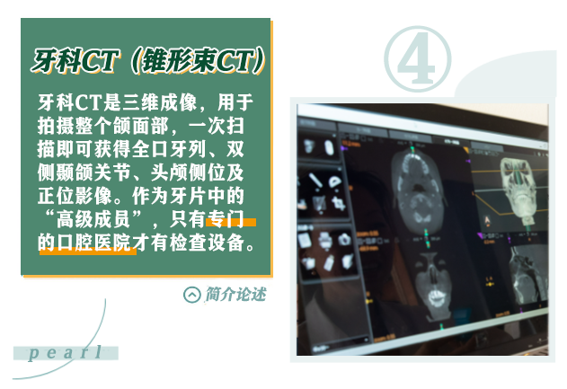 X光拍片为什么要等看牙为什么要拍片？非专业人士如何看懂自己的牙片！_https://www.jmylbn.com_新闻资讯_第7张