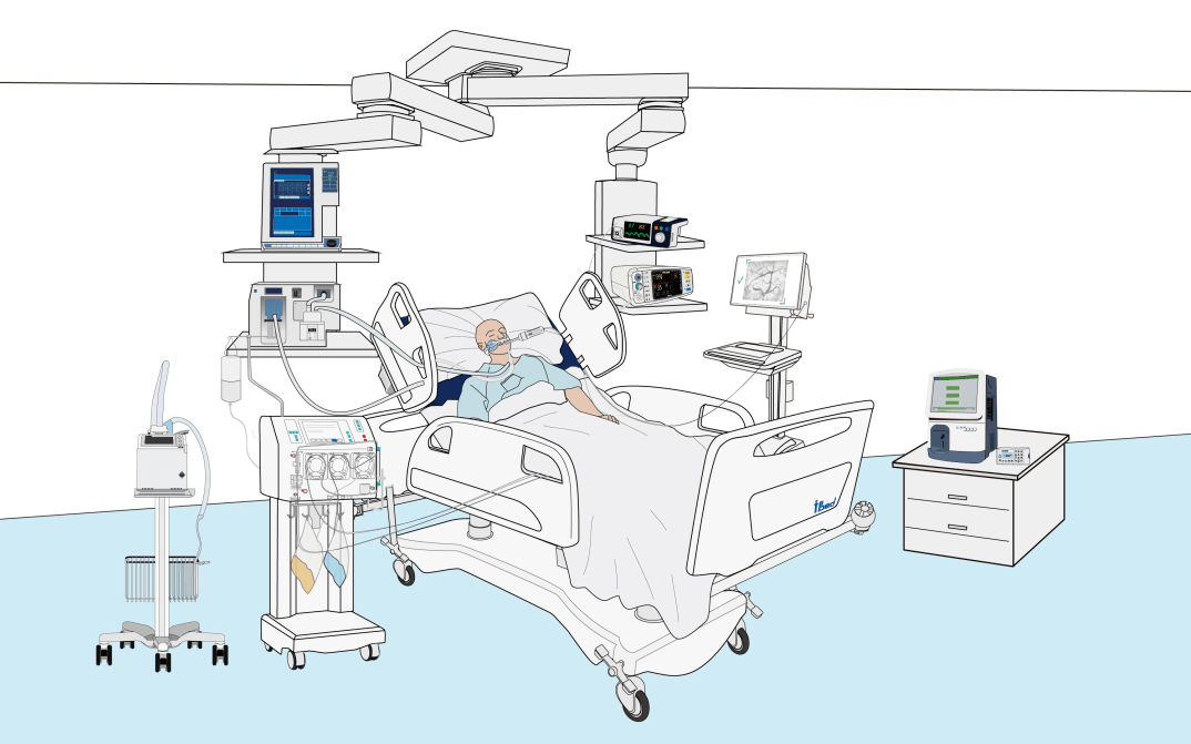 全麻后为什么送icu为什么全麻手术后患者要在ICU监护——从死神手里抢回来的病人告诉你答案_https://www.jmylbn.com_新闻资讯_第5张