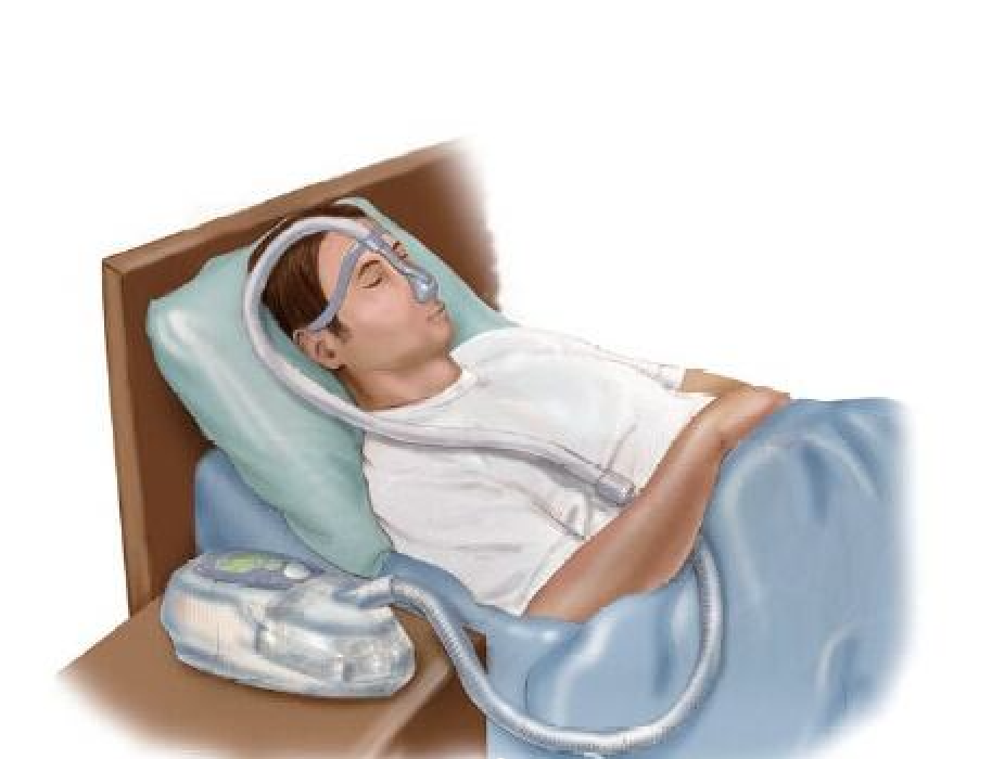 睡眠呼吸机怎么调节关于睡眠期无创呼吸机，您应知道的几件事_https://www.jmylbn.com_新闻资讯_第2张