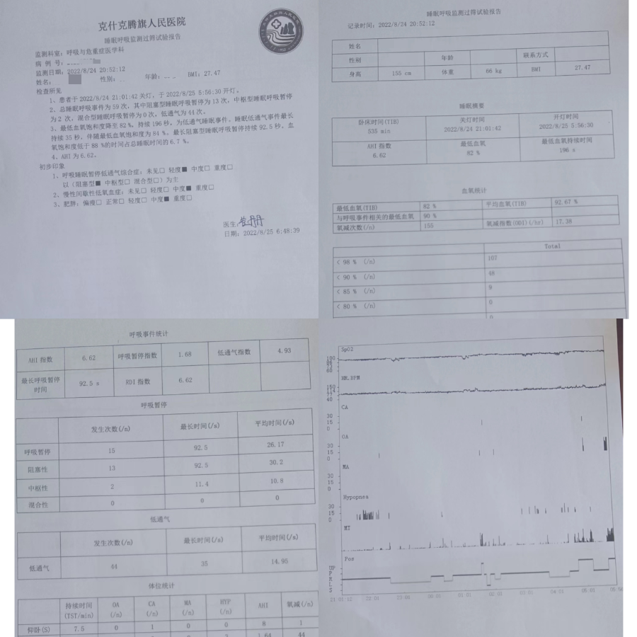呼吸睡眠监测仪怎么用精致医疗 ｜ 打鼾？睡不好？做个睡眠呼吸监测吧!_https://www.jmylbn.com_新闻资讯_第6张