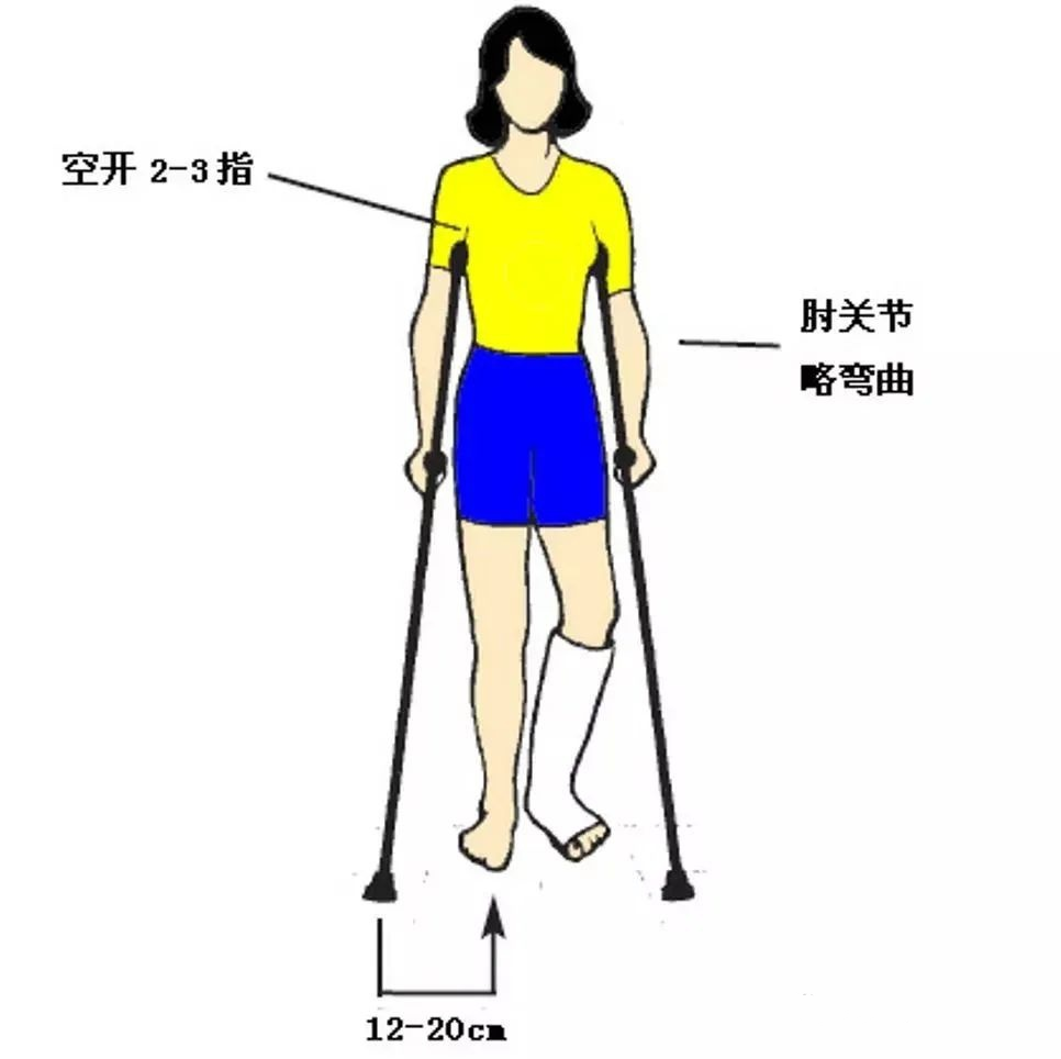 医用拐杖怎么用健康科普｜医用拐杖的使用，你了解多少？_https://www.jmylbn.com_新闻资讯_第4张