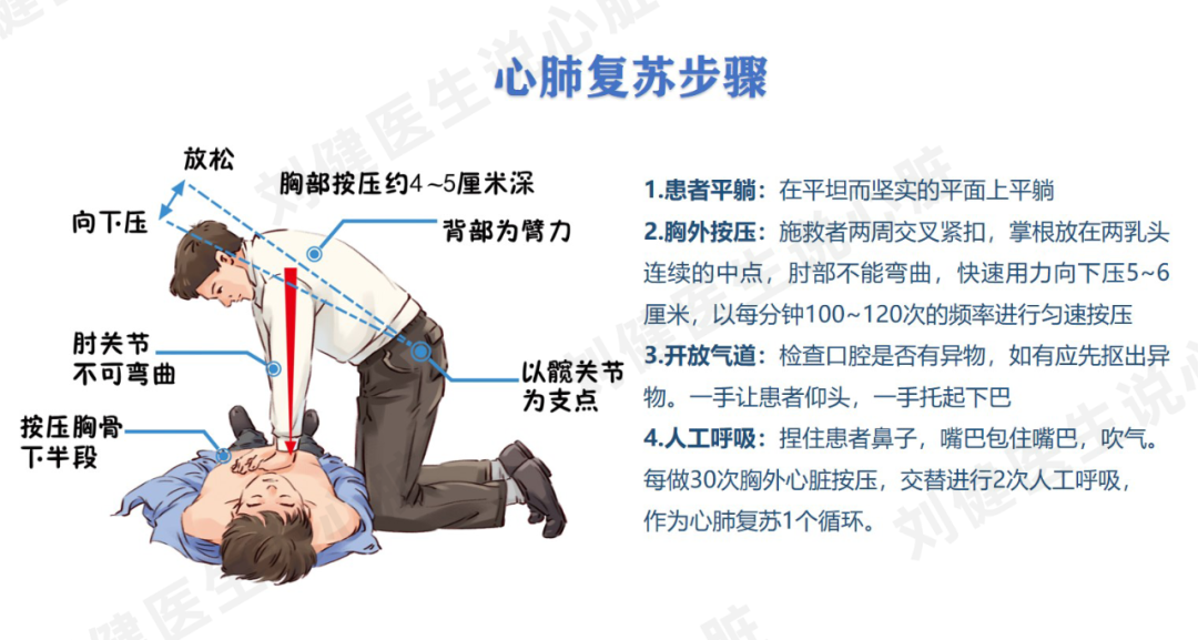 急性心肌梗死如何快速高效急救？