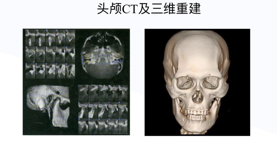 口腔ct什么牌子好“聪明可靠”的口腔全景CT来喽！赶紧上车来“瞧瞧”~_https://www.jmylbn.com_新闻资讯_第9张