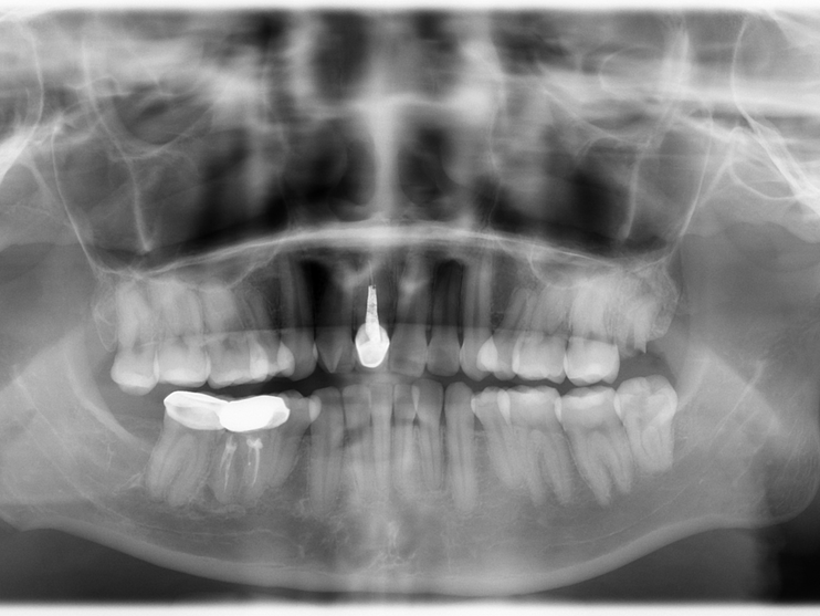 口腔ct什么牌子好“聪明可靠”的口腔全景CT来喽！赶紧上车来“瞧瞧”~_https://www.jmylbn.com_新闻资讯_第5张