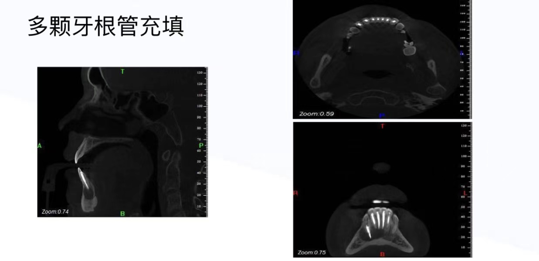 口腔ct什么牌子好“聪明可靠”的口腔全景CT来喽！赶紧上车来“瞧瞧”~_https://www.jmylbn.com_新闻资讯_第8张