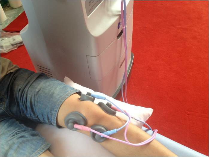 为什么理疗用电极刺激康复理疗指南 ｜ 低、中、高频电疗法精准化参数、电极放置和风险防范指南_https://www.jmylbn.com_新闻资讯_第23张