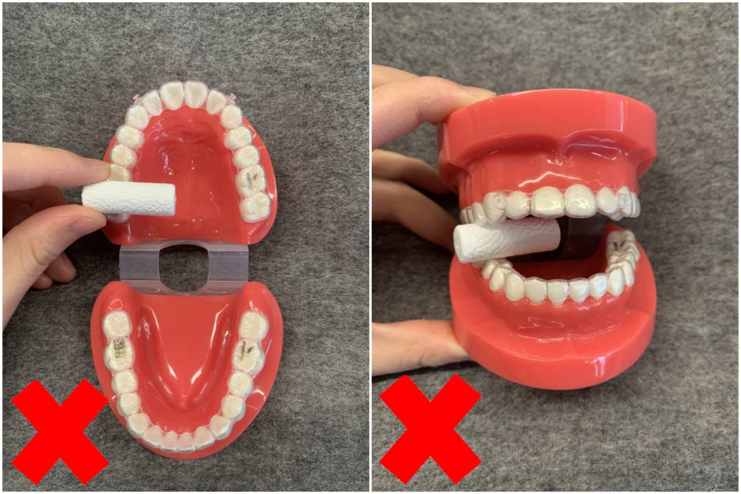 牙科材料硅胶怎么用隐形矫正中，咬胶如何正确使用_https://www.jmylbn.com_新闻资讯_第18张